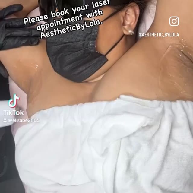 Brazilian and Underarm at Aestheticbylola in Bronx, NY